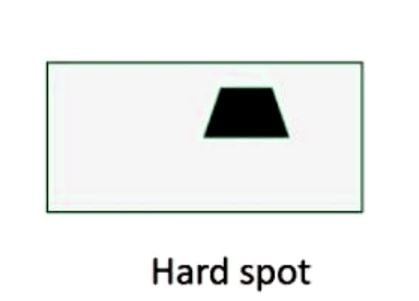 Hot or Hard Spot - Casting Defects